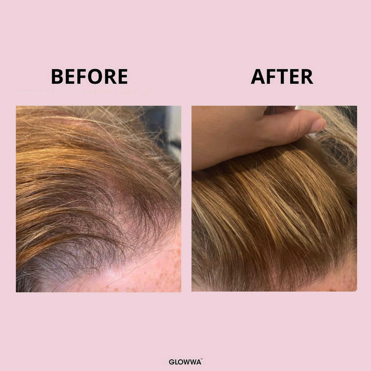 HAIR FOOD | 3 MONATE VORRAT