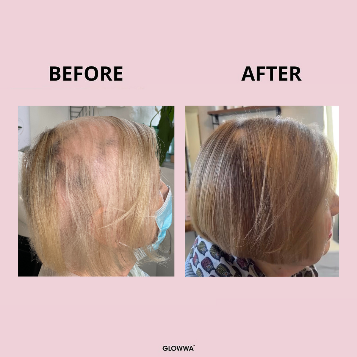 HAIR FOOD | 3 MONATE VORRAT
