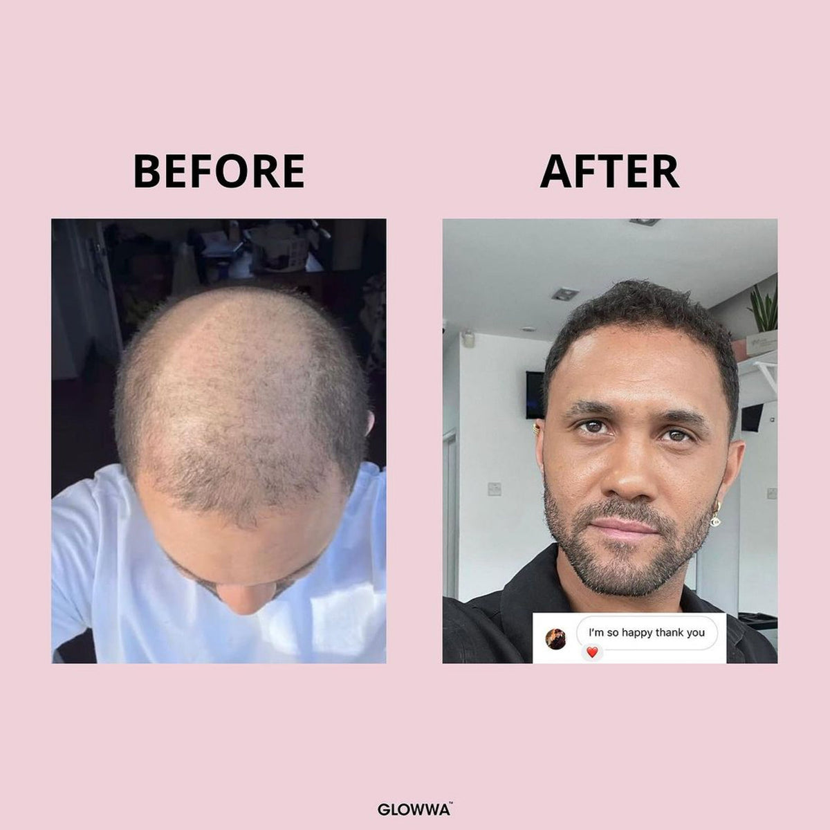 HAIR FOOD | 3 MONATE VORRAT