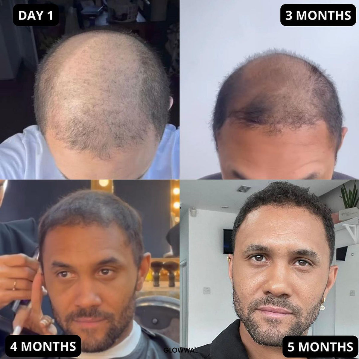 HAIR FOOD | 3 MONATE VORRAT